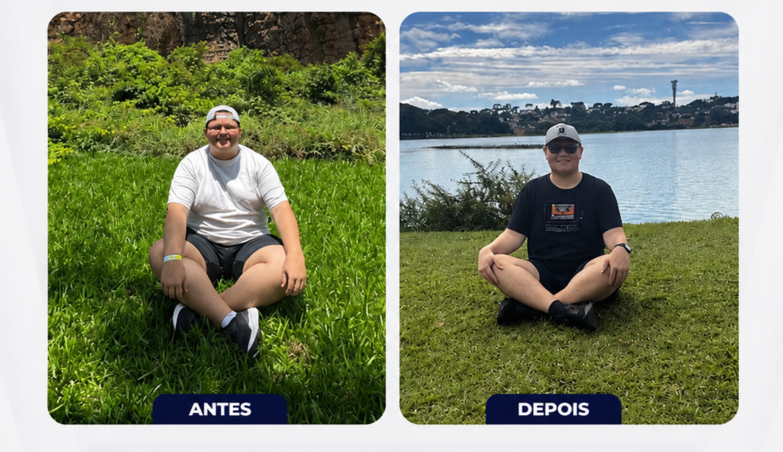 Colagem antes e depois de paciente sentado ao ar livre em área verde, evolução corporal, fotografia realista